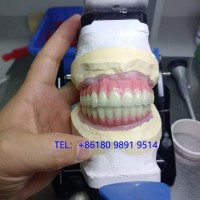 深圳种植牙Dental Implant外贸出口